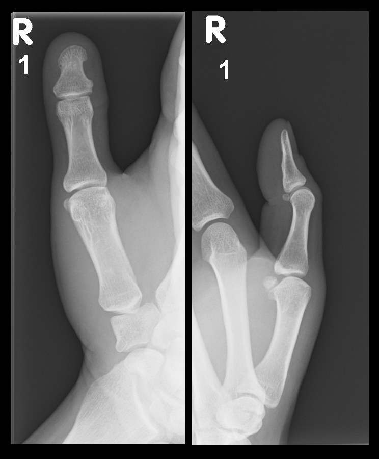 X-ray photos